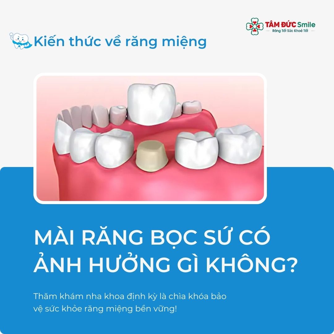 MÀI RĂNG BỌC SỨ CÓ ẢNH HƯỞNG GÌ KHÔNG? ĐỊA CHỈ LÀM RĂNG SỨ ĐẸP