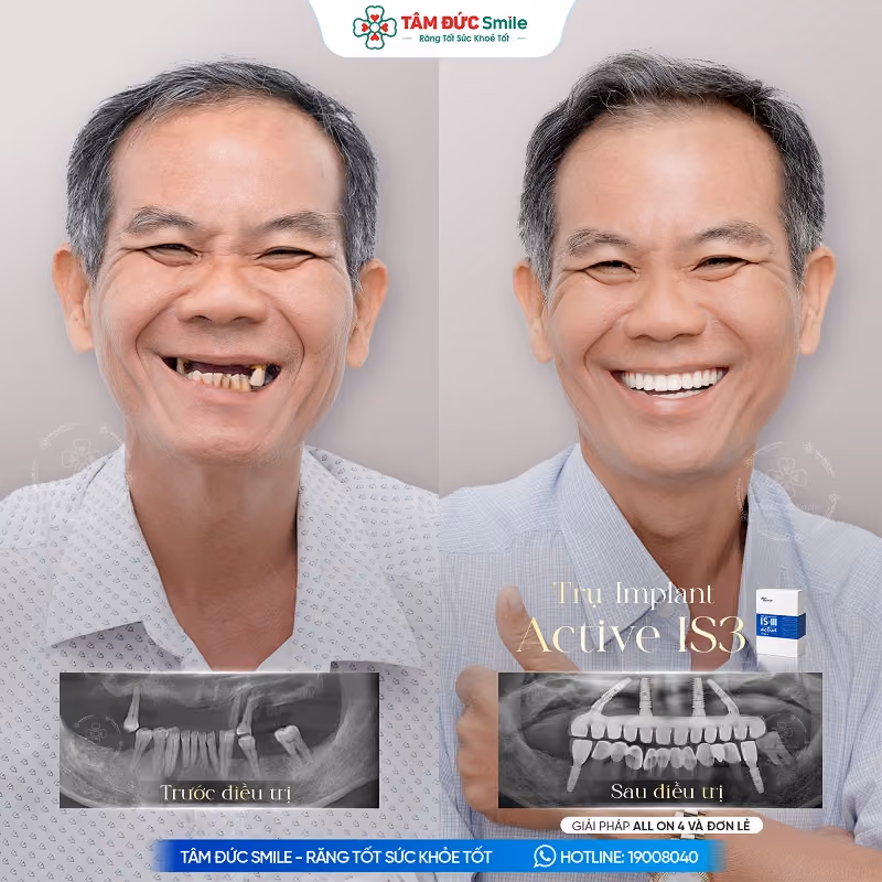 khach-hang-thanh-son-1