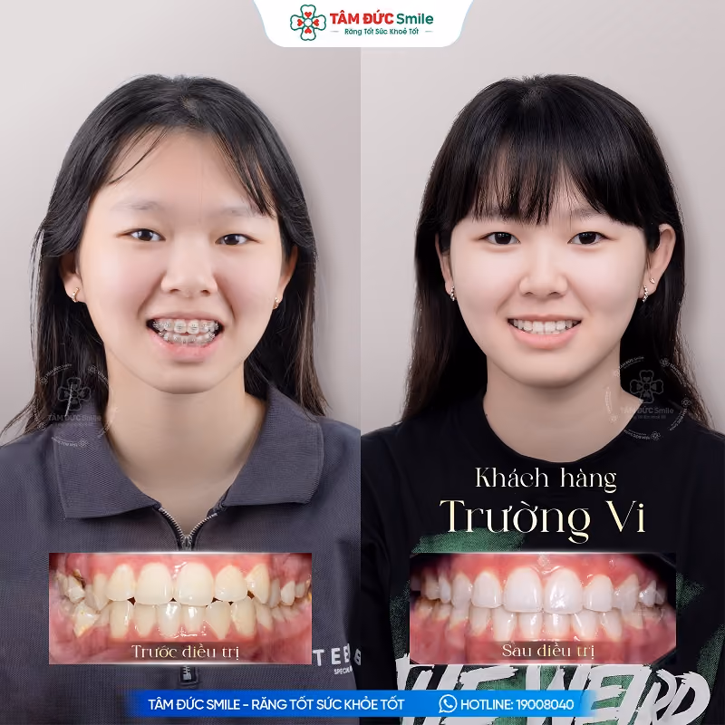 khach-hang-truong-vi