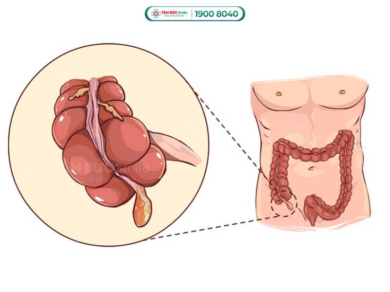  1 năm tẩy giun mấy lần