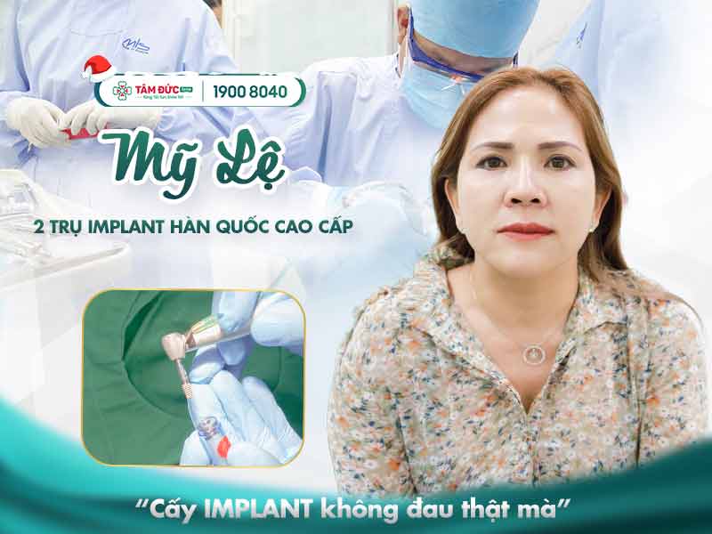 chị mỹ lệ trồng răng implant tại tâm đức smile