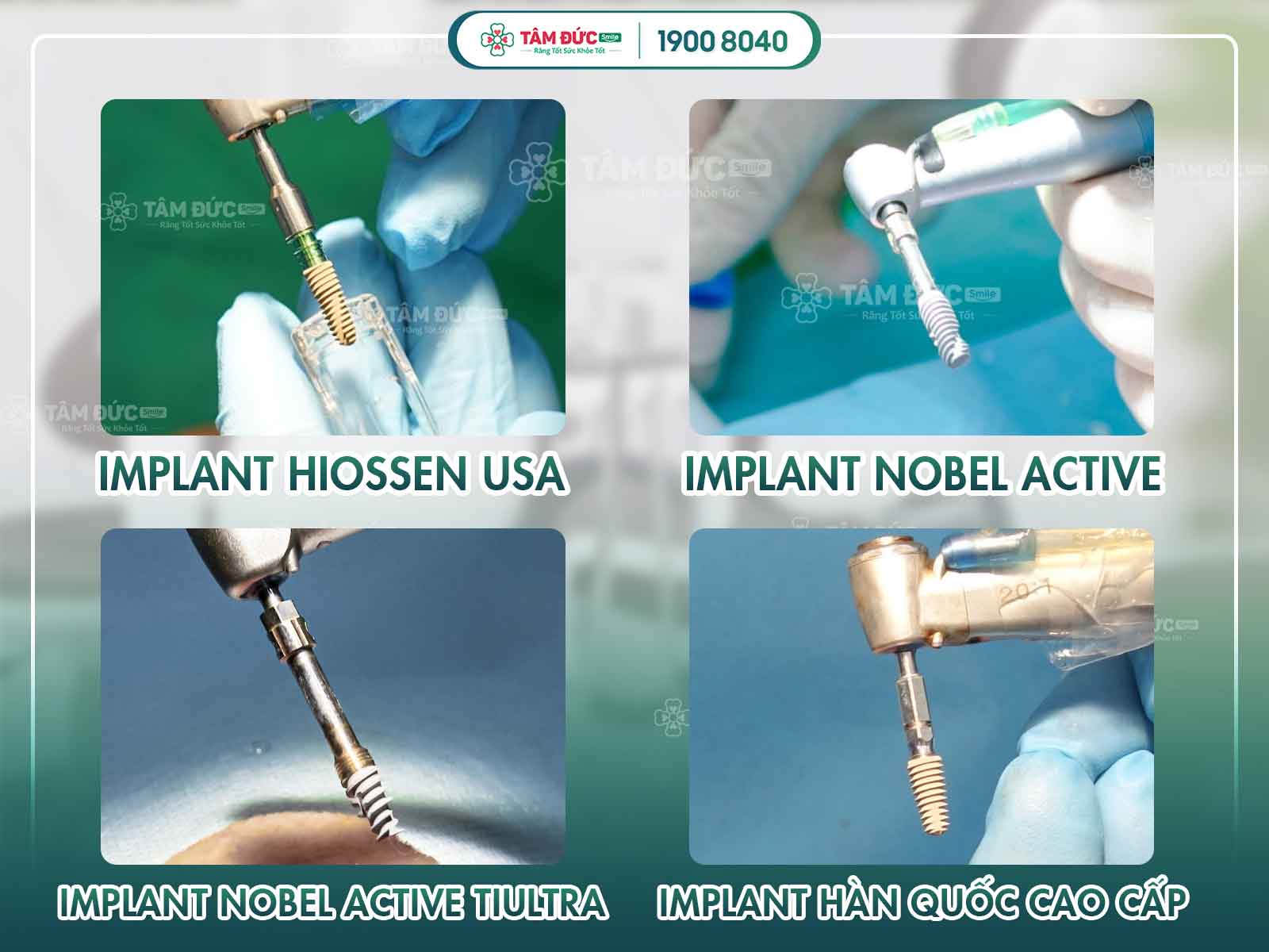 Ưu điểm của Implant All on 4 thể hiện trên các trụ implant cao cấp