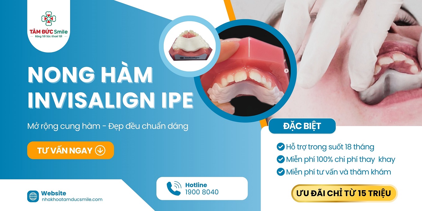 ƯU ĐÃI ĐẶC BIỆT 2025: NONG HÀM IPE INVISALIGN CHỈ 15 TRIỆU ĐỒNG 
