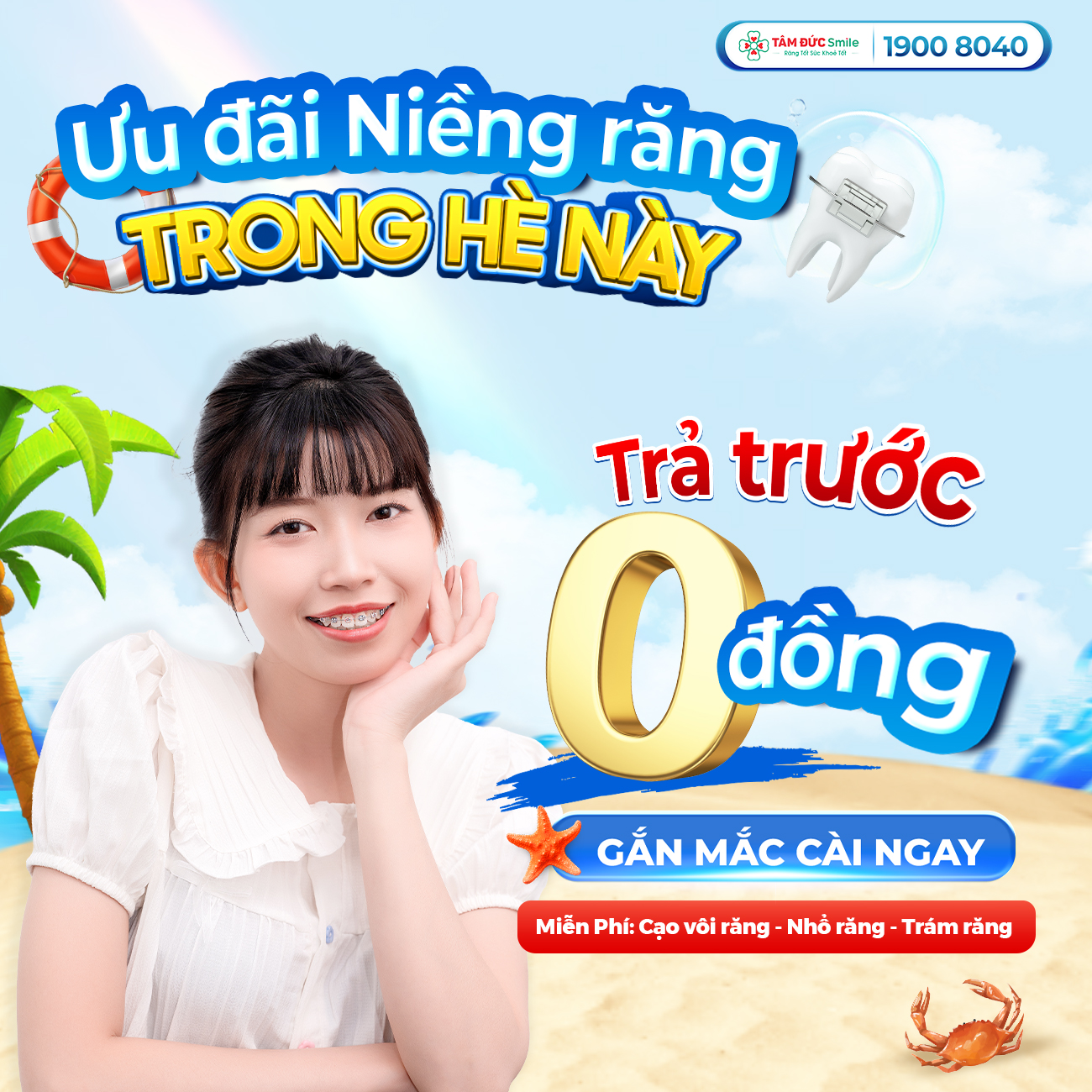 Niềng Răng Baner Lớn