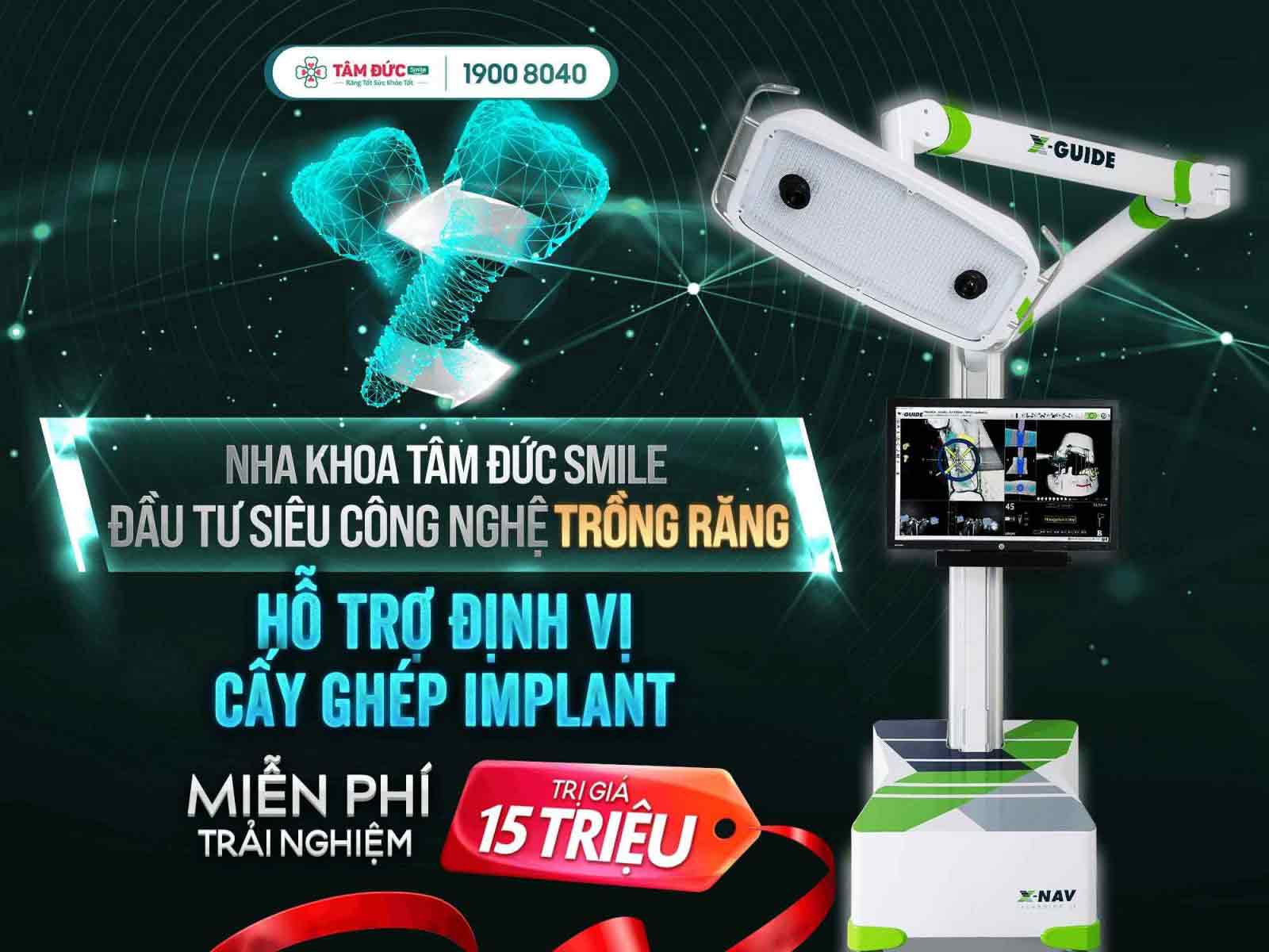 thiết bị định vị x-guide