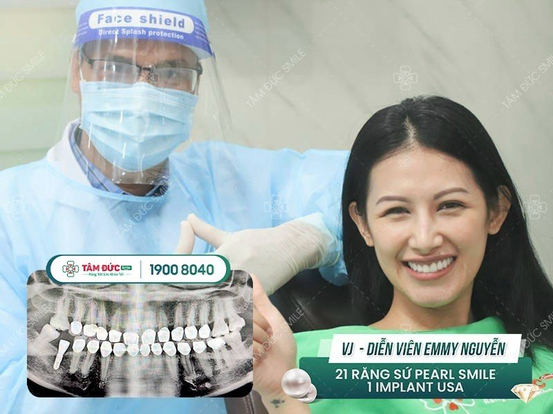 bảng giá trồng răng implant tại nha khoa Tâm Đức Smile