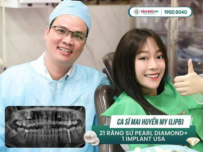 bảng giá trồng răng Implant tại nha khoa Tâm Đức Smile