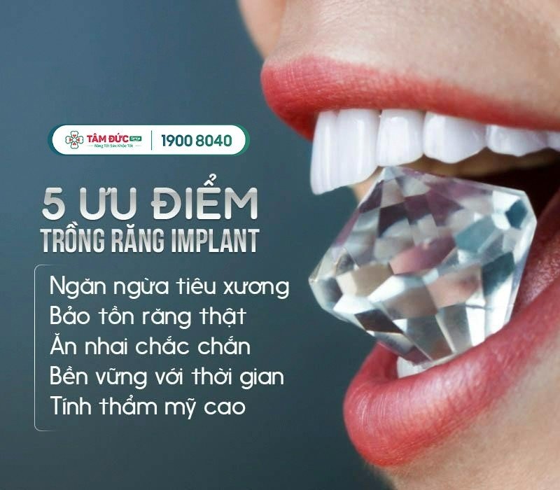 bảng giá trồng răng sứ tại nha khoa Tâm Đức Smile