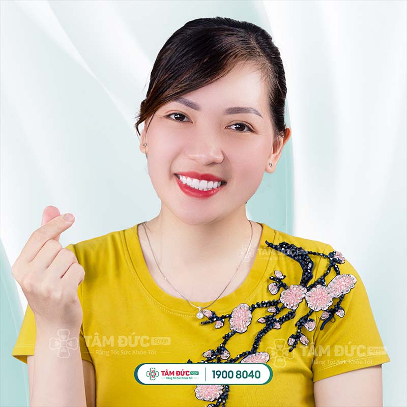 khách hàng bọc răng sứ tại nha khoa Tâm Đức Smile