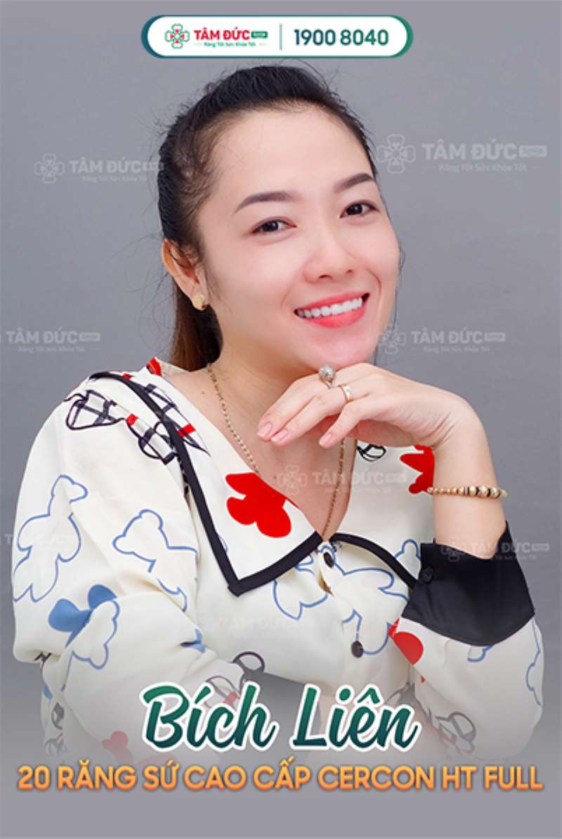 bọc răng sứ cho răng cửa bằng loại sứ cercon ht full