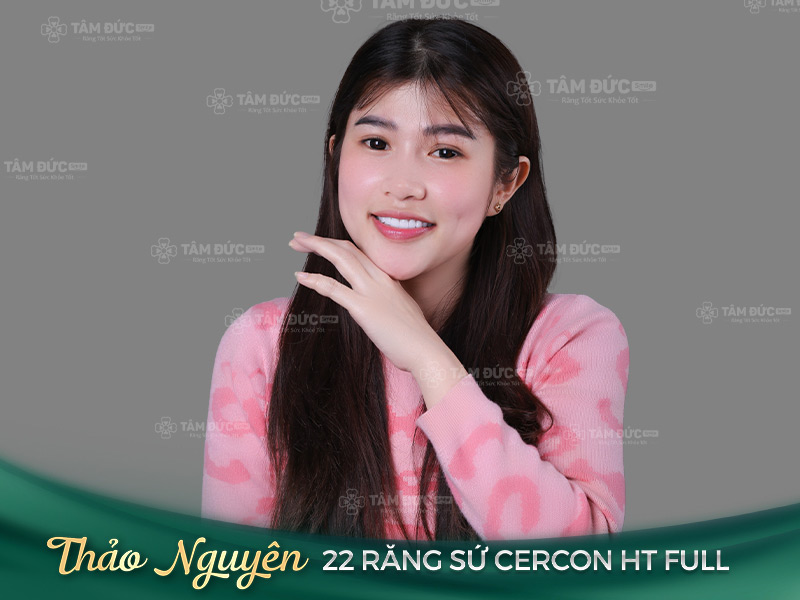 chị Thảo Nguyên sau khi bọc răng sứ tại Tâm Đức Smile