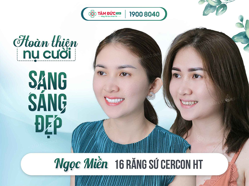 bọc răng sứ ở đâu tốt nhất