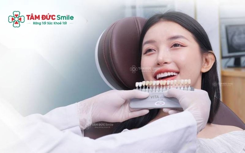 Bọc răng sứ thẩm mỹ tại Nha khoa Tâm Đức Smile – Ưu đãi 60%, bền đẹp tự nhiên