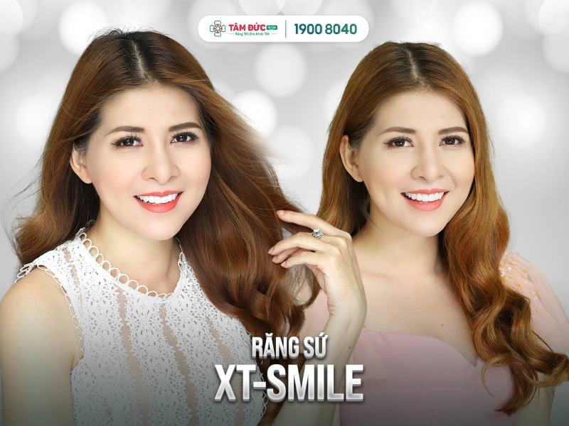 răng sứ XT Smile