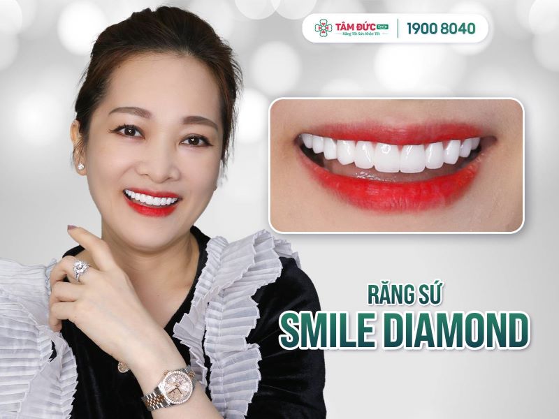 răng sứ Smile Diamond sáng bóng đặc biệt