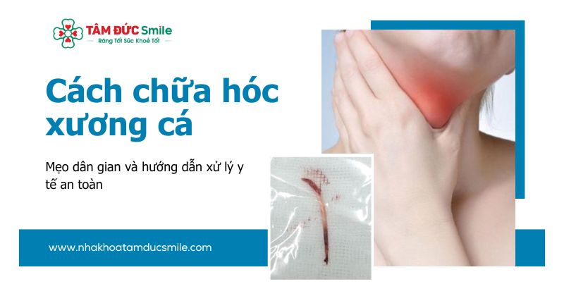 Cách chữa hóc xương cá hiệu quả: mẹo dân gian và hướng dẫn xử lý y tế an toàn