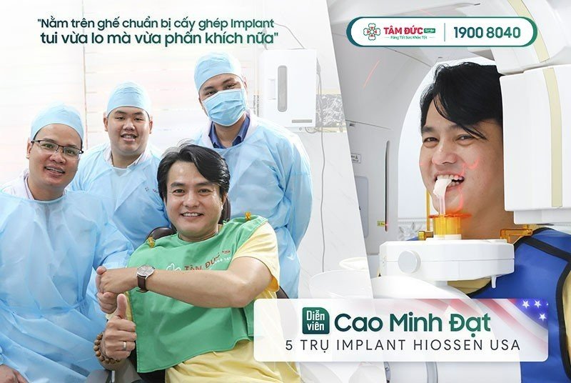 Cách nhận biết các trụ implant phổ biến