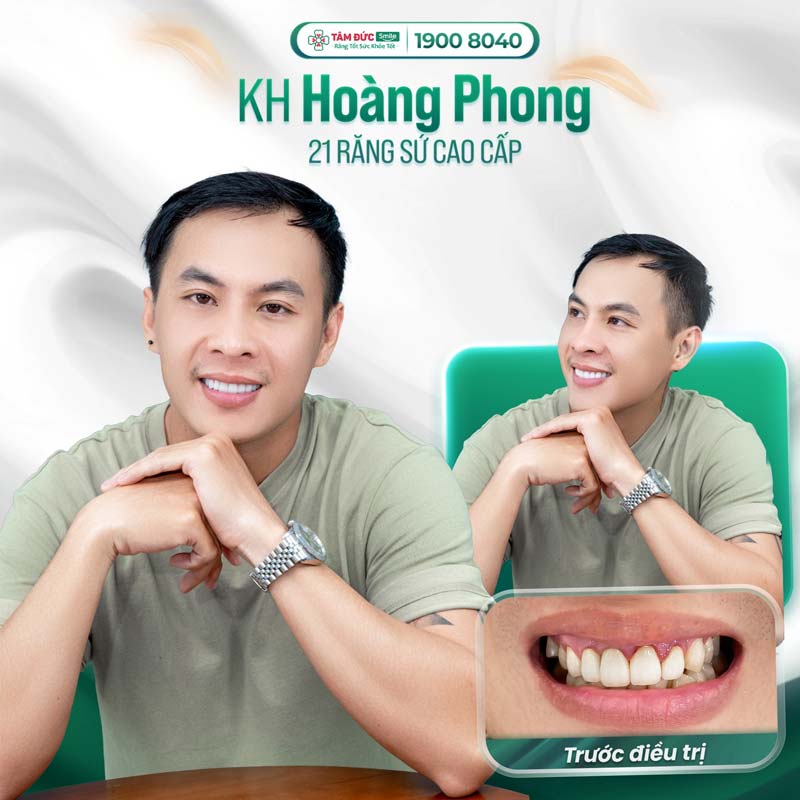 khách hàng làm bọc răng sứ phong thuỷ dáng răng rồng