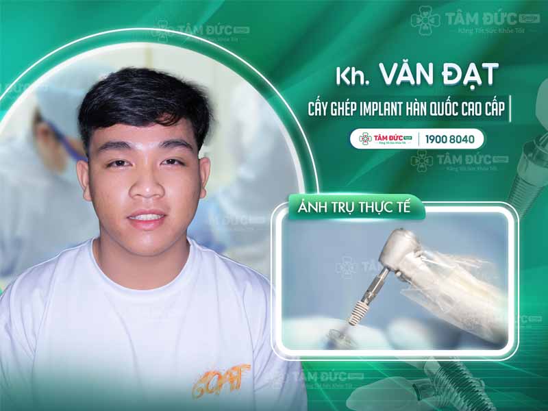 khách hàng trồng răng Implant tại nha khoa Tâm Đức Smile