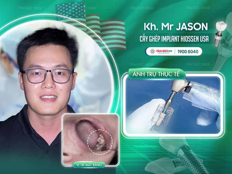 khách hàng trồng răng Implant tại nha khoa Tâm Đức Smile