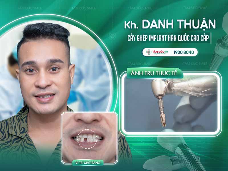 khách hàng trồng răng Implant tại nha khoa Tâm Đức Smile