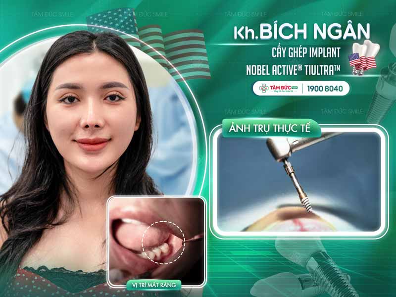 khách hàng trồng răng Implant tại nha khoa Tâm Đức Smile