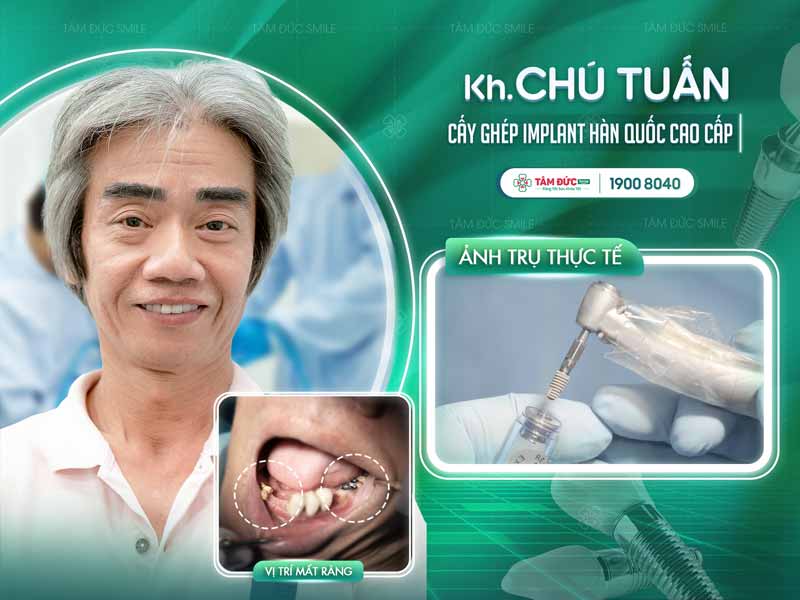 khách hàng trồng răng Implant tại nha khoa Tâm Đức Smile