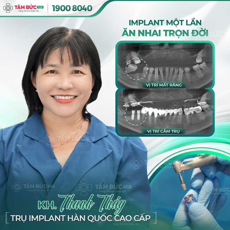 khách hàng trồng răng tại nha khoa Tâm Đức Smile