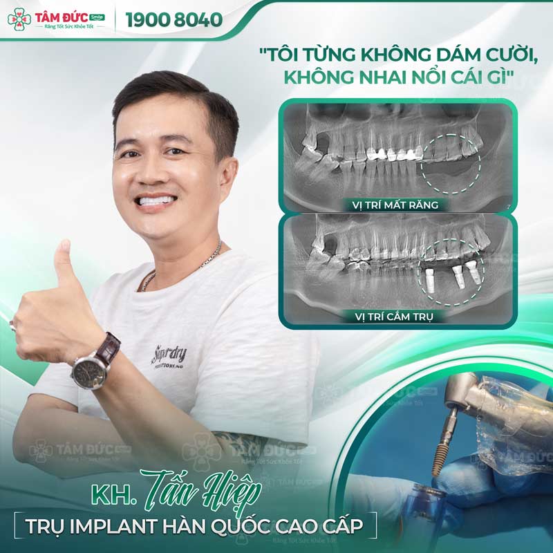 khách hàng trồng răng tại nha khoa Tâm Đức Smile