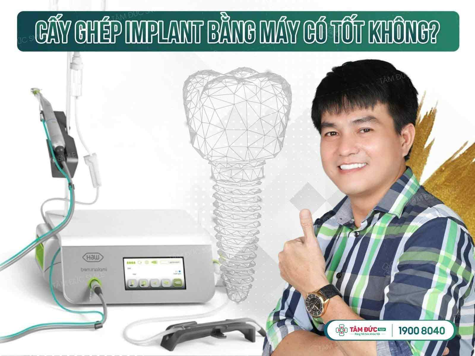 implant giá rẻ