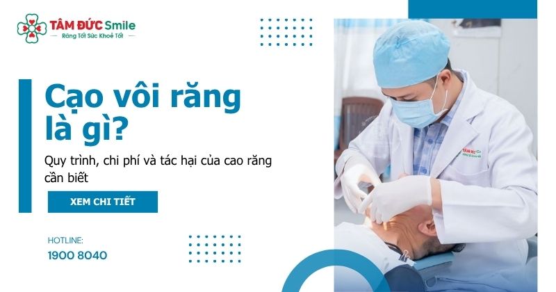 Cạo vôi răng là gì? Quy trình, chi phí và tác hại của cao răng cần biết