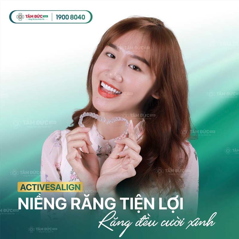 các độ tuổi niềng răng