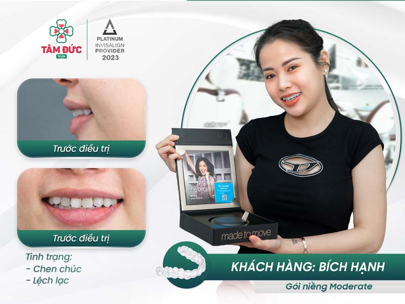 khách hàng niềng răng trong suốt tại nha khoa Tâm Đức Smile