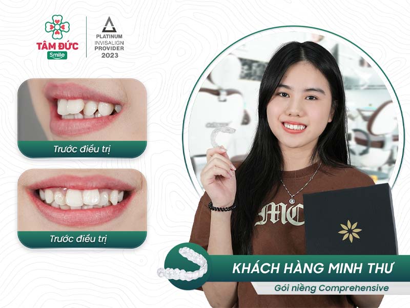 khách hàng niềng răng tại nha khoa Tâm Đức Smile