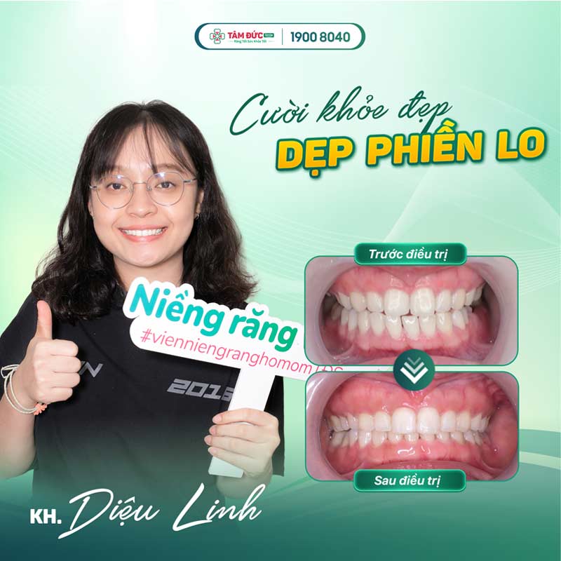 khách hàng trước và sau khi niềng răng tại nha khoa Tâm Đức Smile