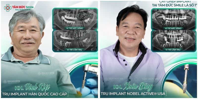 cay-ghep-implant-hai-chau-4