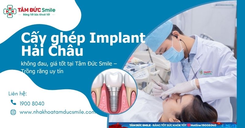 Cấy ghép Implant Hải Châu không đau, giá tốt tại Tâm Đức Smile – Trồng răng uy tín