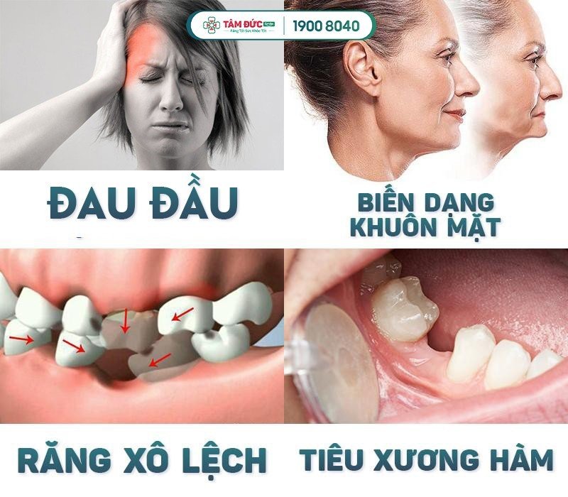 ảnh hưởng của việc mất răng