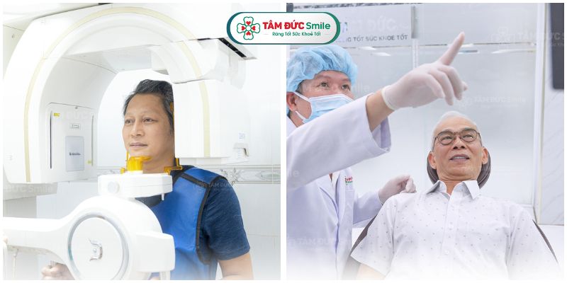 cay-ghep-implant-toan-ham-5