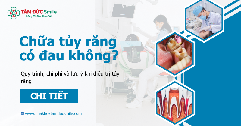 Chữa tủy răng có đau không? Quy trình, chi phí và lưu ý khi điều trị tủy răng