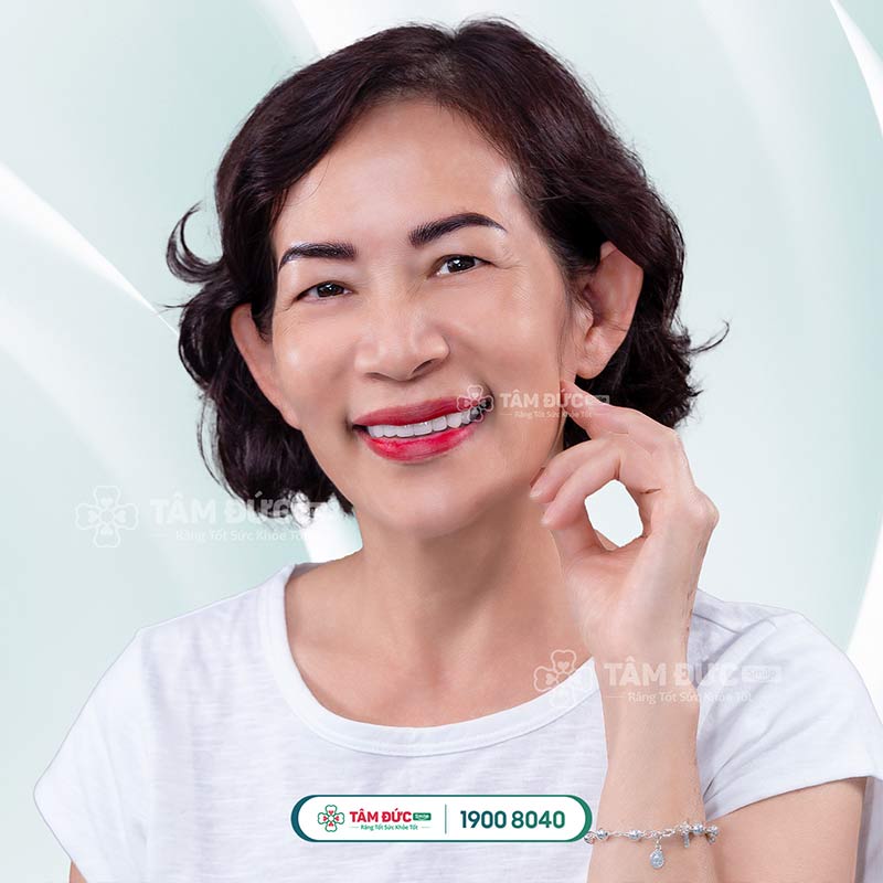 khách hàng bọc răng sứ tại nha khoa Tâm Đức Smile