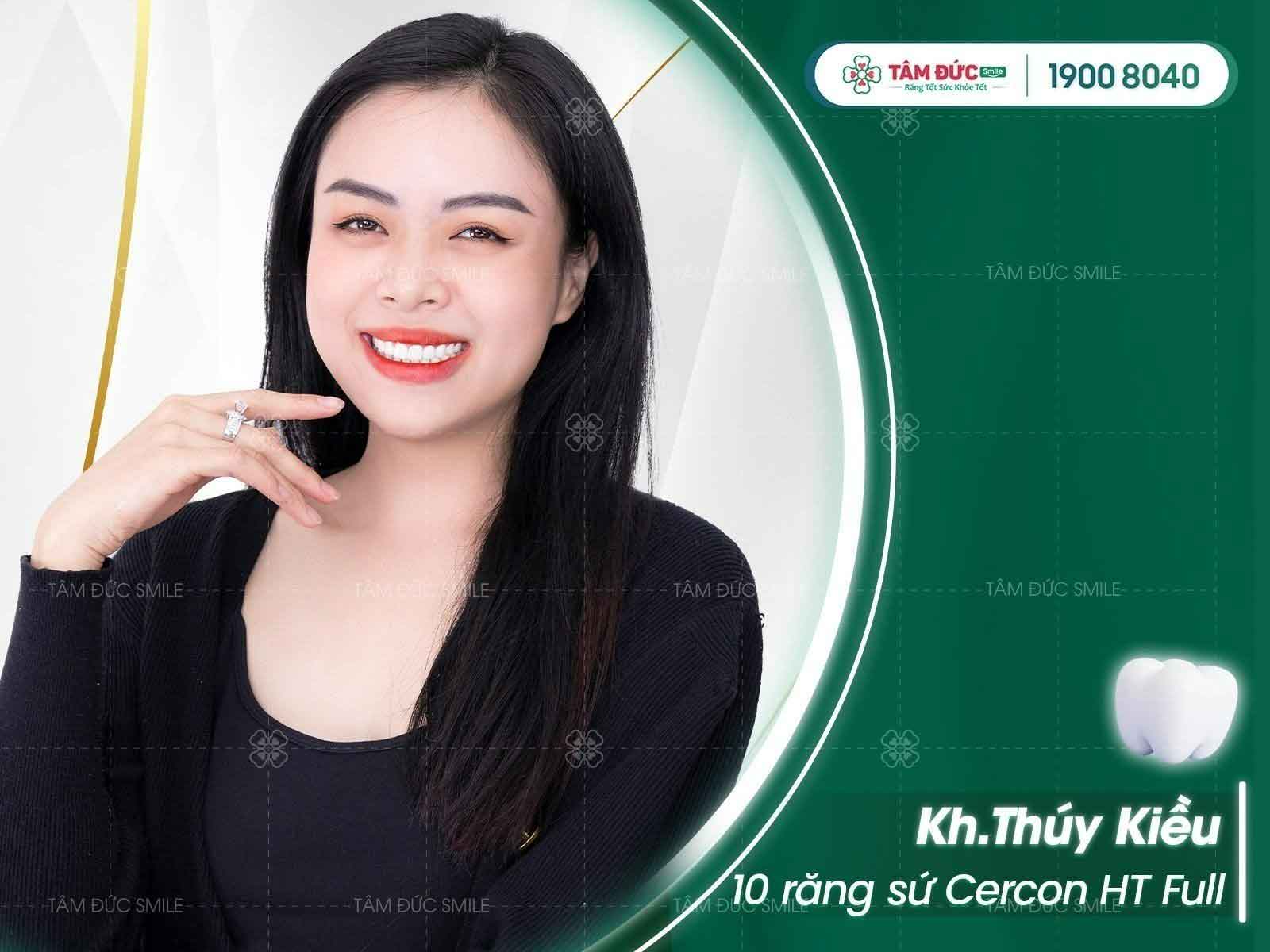 chị Thuý Kiều sau khi bọc răng sứ tại nha khoa Tâm Đức Smile