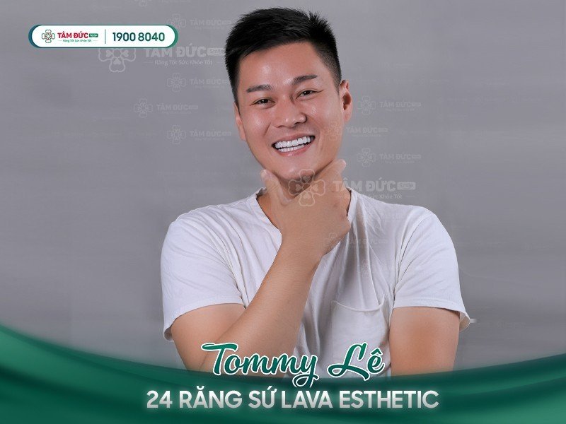 dáng răng sứ của anh Tommy Lê