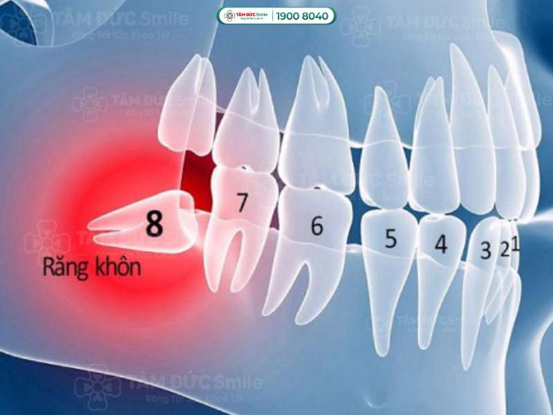 đau răng buốt lên đầu có nguy hiểm không