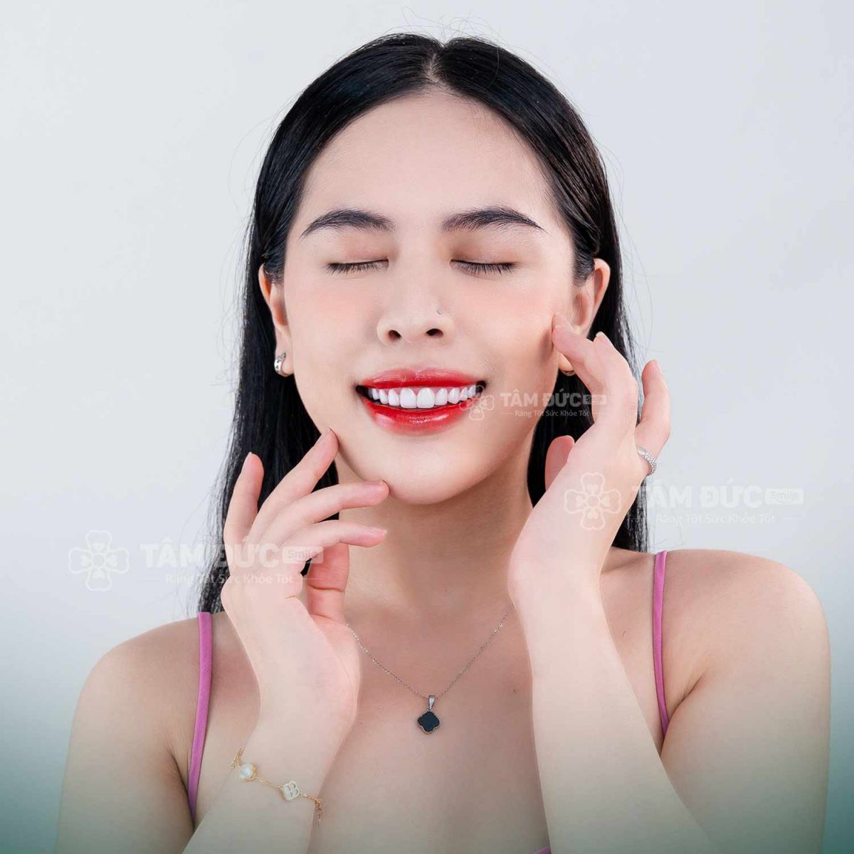 khách hàng bọc răng sứ tại nha khoa tâm đức smile