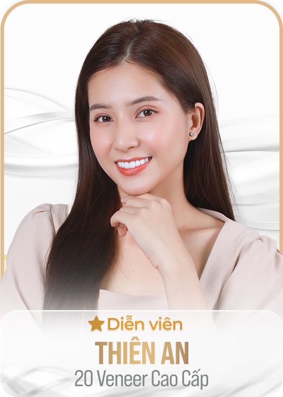 diễn viên thiên an 20 veneer cao cấp