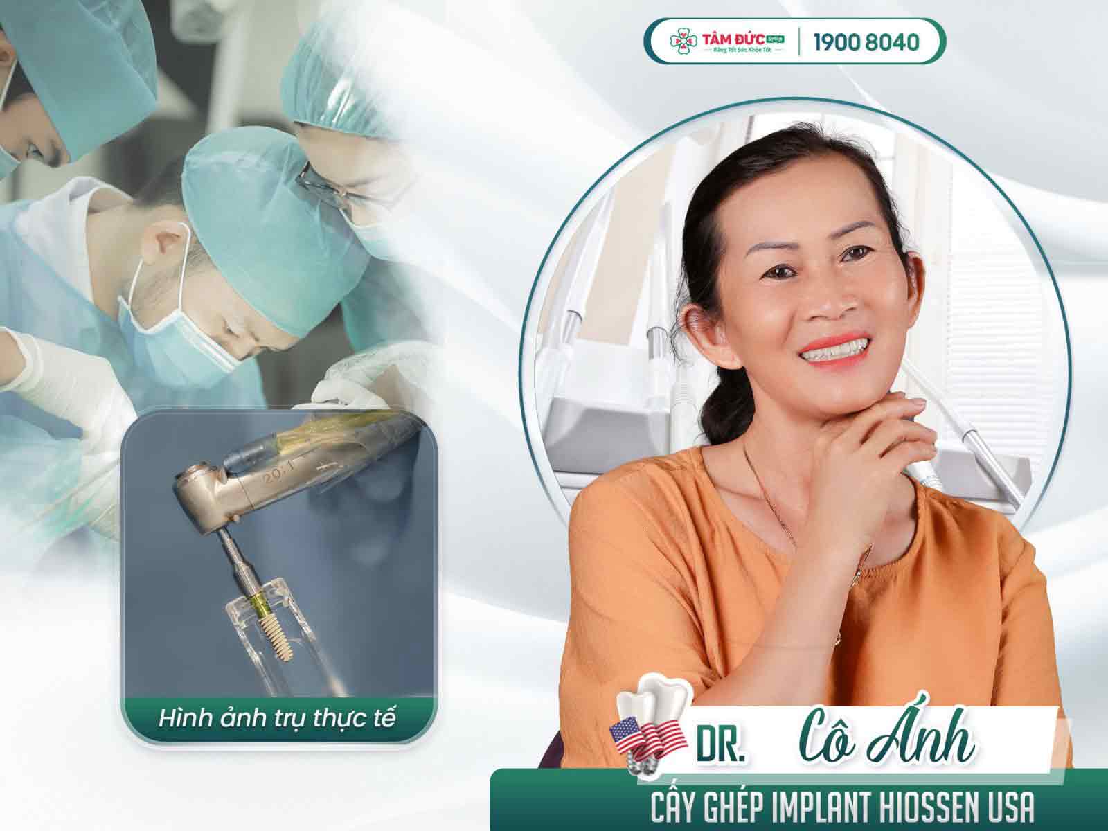 địa chỉ cấy ghép implant uy tín cho việt kiều