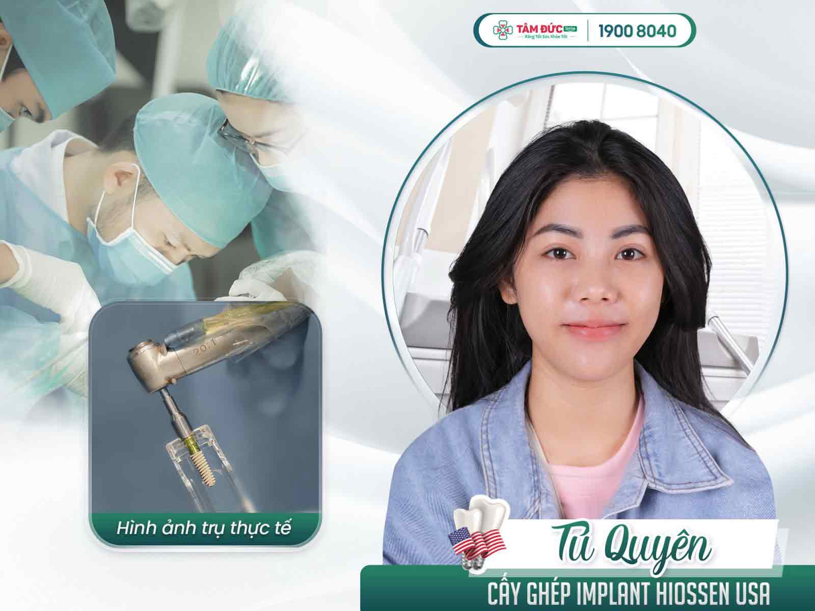 địa chỉ trồng răng implant uy tín cho việt kiều