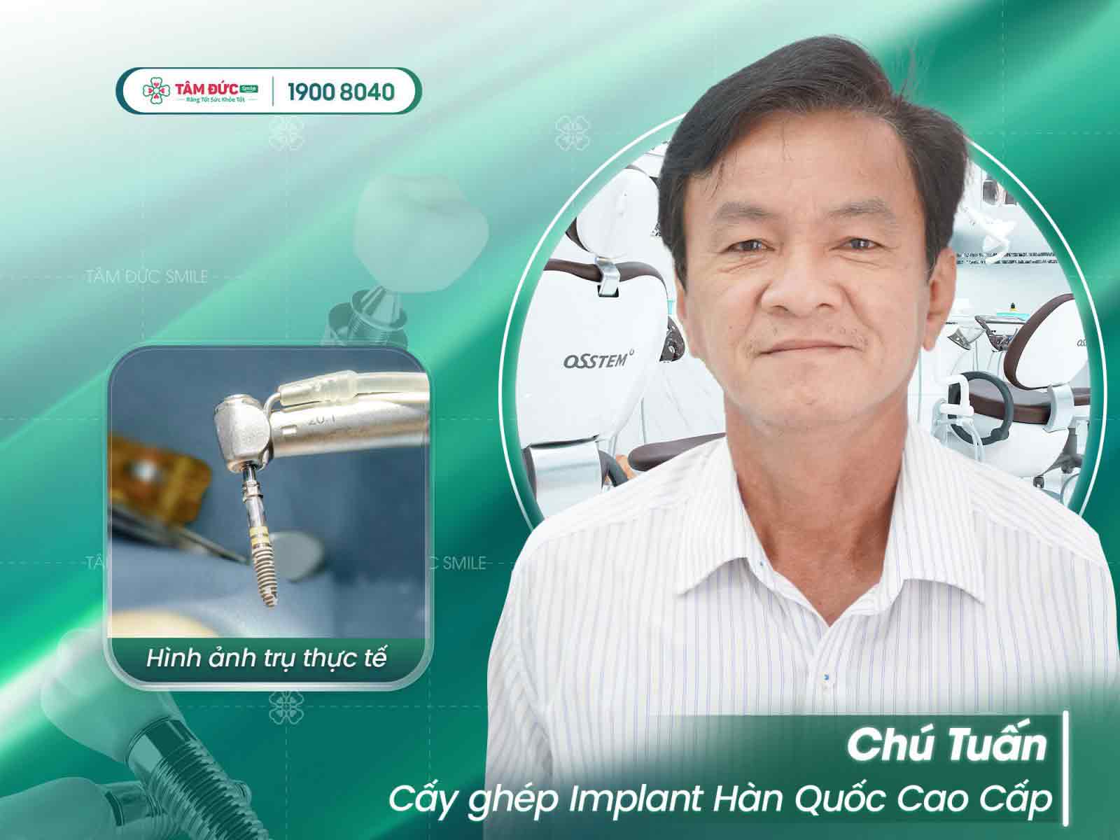 chú tuấn cấy ghép implant tại nha khoa tâm đức smile