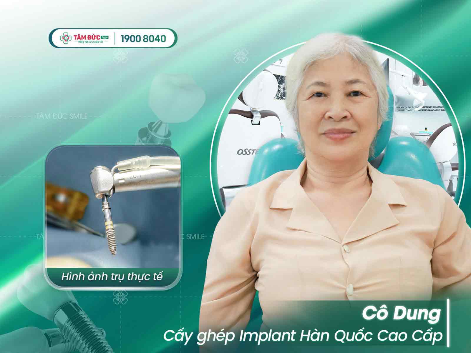 địa chỉ cấy ghép implant chất lượng cho việt kiều